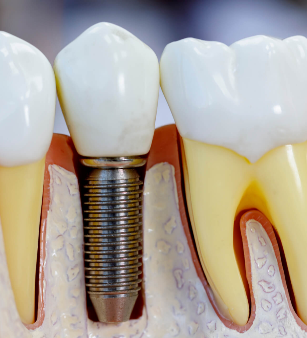 Inova Odontologia - 2000x1333 (3)