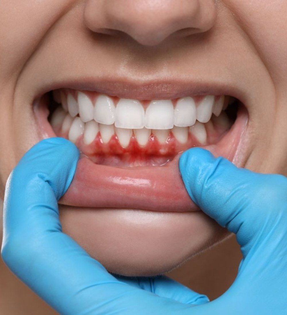 Inova Odontologia - 2000x1333 (8)