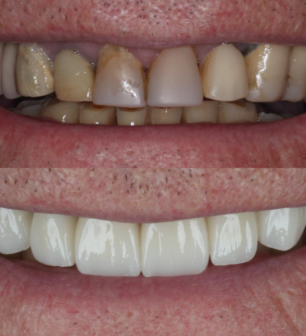 Inova Odontologia - 2000x1333 (9)